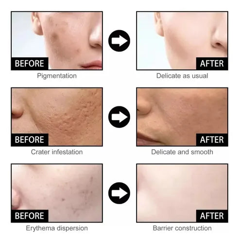 Serum facial con nicotinamida