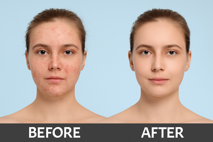 Serum facial con nicotinamida