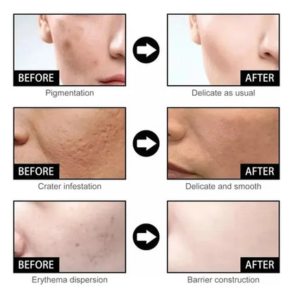 Serum facial con nicotinamida